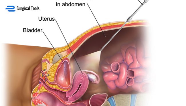 Laparotomy Instrument set